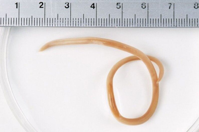 dimensione dei vermi nel corpo