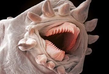 quali vermi possono vivere nel corpo umano