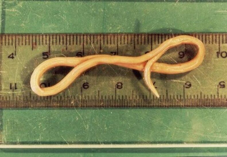 parassita nematode dal corpo umano