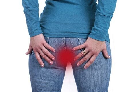 prurito all'ano come indicazione per il test antiparassitario