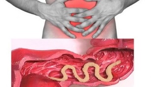 sintomi della presenza di parassiti nell'intestino umano